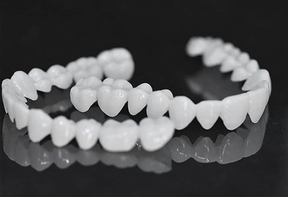 Kosmetische Zahn-Topper SmileShape – Wiederverwendbar, Flexibel und Natürlich Weiß | Karnz