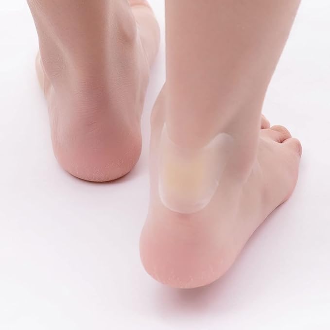 Karnz | SootheStep – Transparente Gel-Pads, die Blasen sofort verhindern