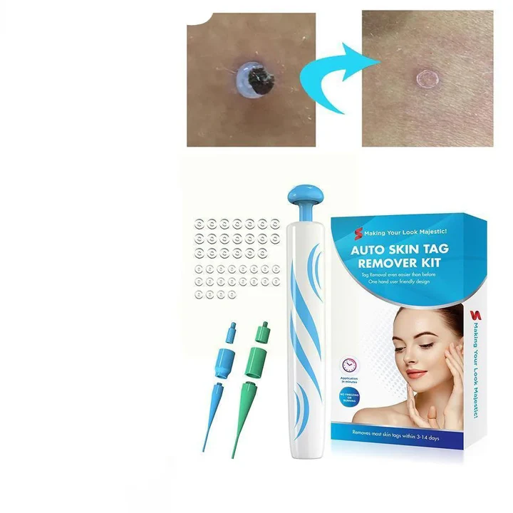 Karnz | DermaClear Hautwarzenentferner | Schmerzfreie Anwendung | Kompakt & Hygienisch | Für Männer & Frauen