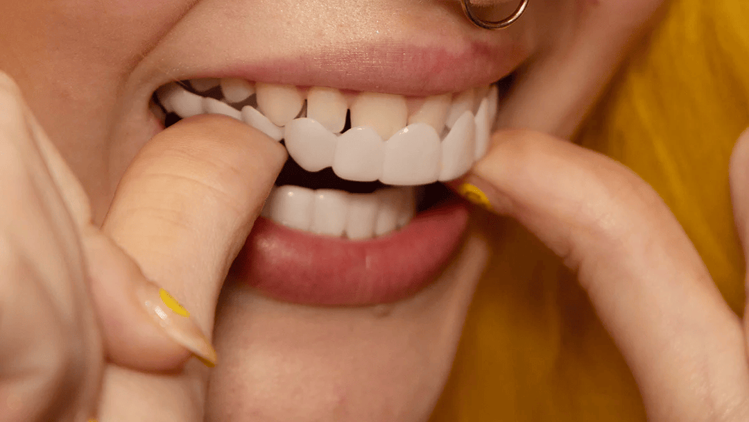 Sandsberg | Snap-On Smile Veneers | Sofortige Zahnaufhellung | Einheitsgröße