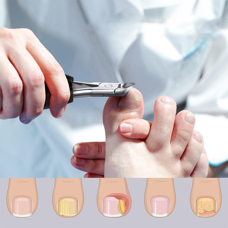 304 Edelstahl Nagelknipser Set | Karnz