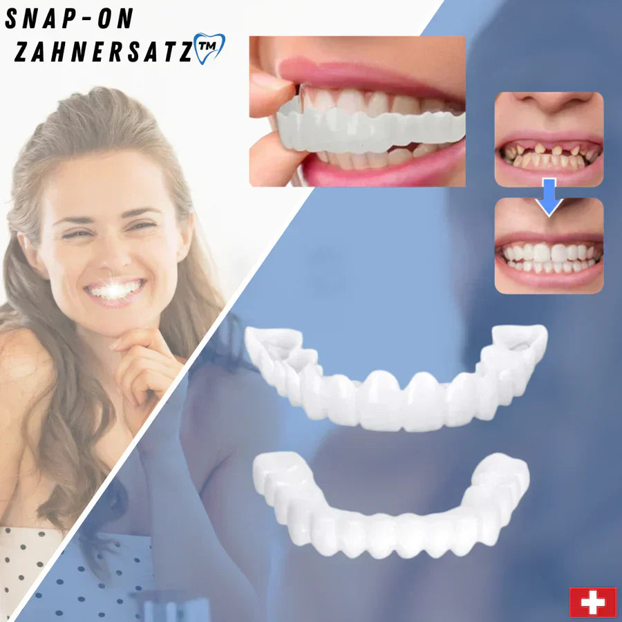 SnapFit Zahnrestauration | Immer ein makelloses Lächeln