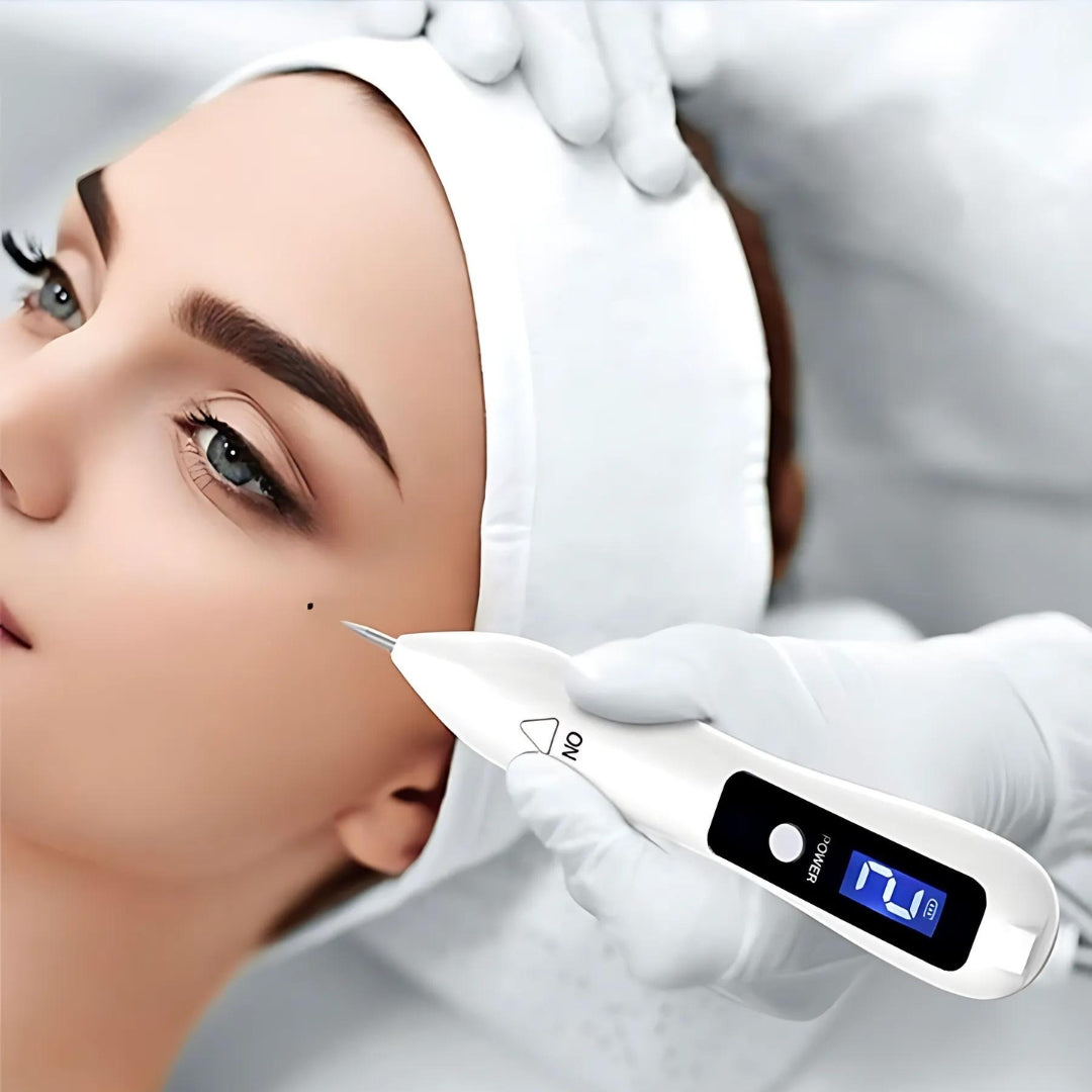 ClearSkinPro Laser Plasma Pen - Nicht-invasiv | zur Entfernung von Sommersprossen, Hautflecken, Punkten, Muttermalen und Tätowierungen zu Hause Karnz