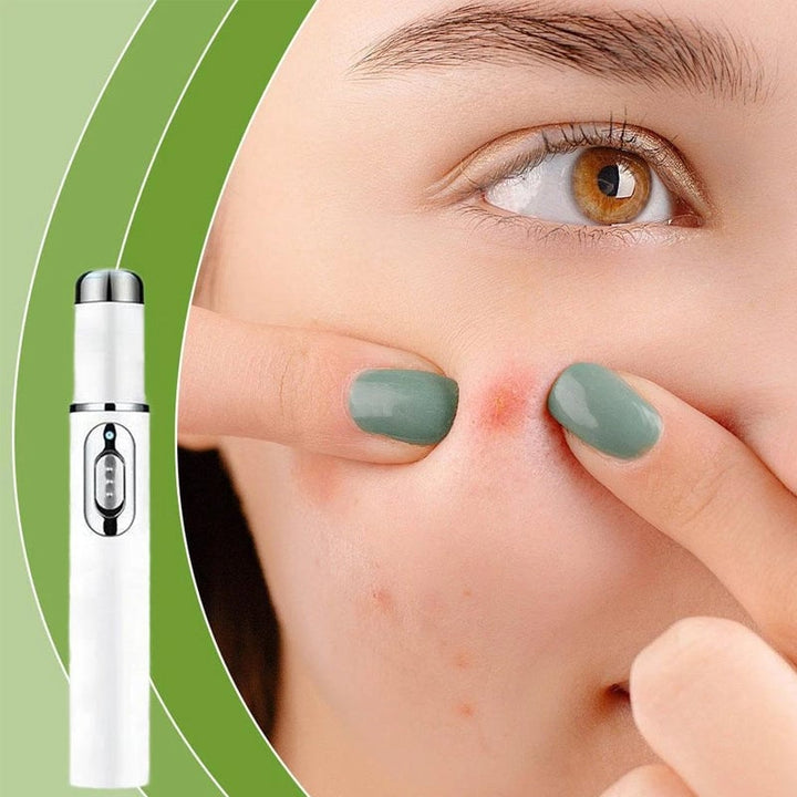 Karnz | ClearDerm - Schnelle, schmerzfreie Pickelentfernung für glatte, klare Haut