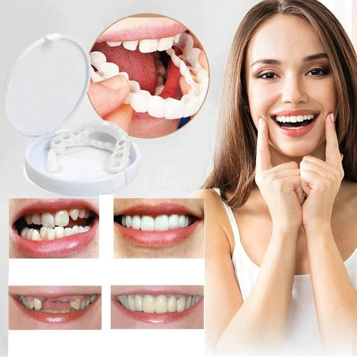 Sandsberg | Snap-On Smile Veneers | Sofortige Zahnaufhellung | Einheitsgröße