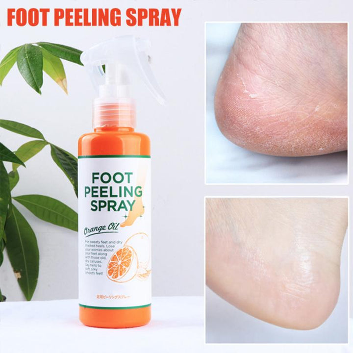 Fußpeeling-Spray