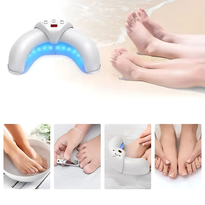 FungiFree | Lasergerät gegen Nagelpilz - Duale Wellenlängenpenetration - Kompakt für den Heimgebrauch - Wiederherstellung von Pilznägeln Karnz