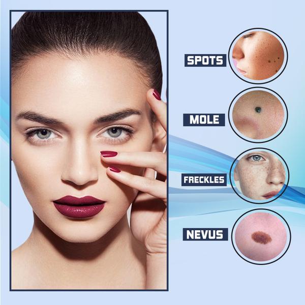 SpotErase™ – Die perfekte Fleckenlösung in nur wenigen Wochen