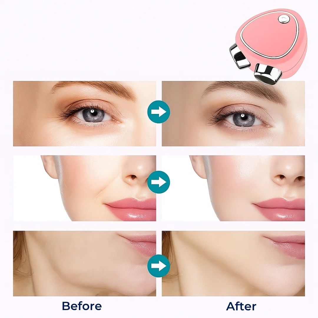 RejuvTone | Gesichts-Toner EMS – Nicht-chirurgisches Lifting – Leichtes USB-wiederaufladbares Gerät – Anti-Aging-Hautpflege Karnz
