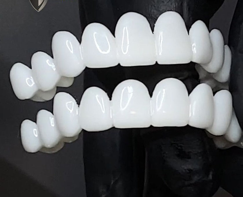 Kosmetische Zahnaufsätze von SmileShape – Wiederverwendbar, flexibel und natürlich weiß