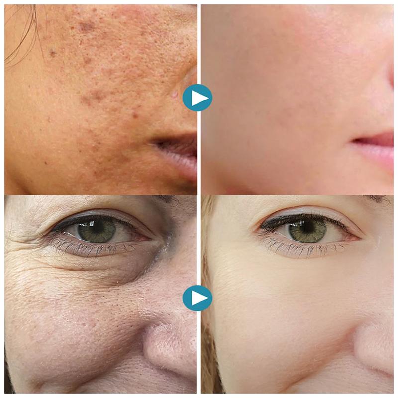 SilkPores Glatte und strahlende Haut | Karnz