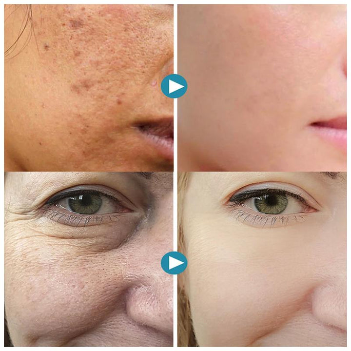 SilkPores Glatte und strahlende Haut | Karnz