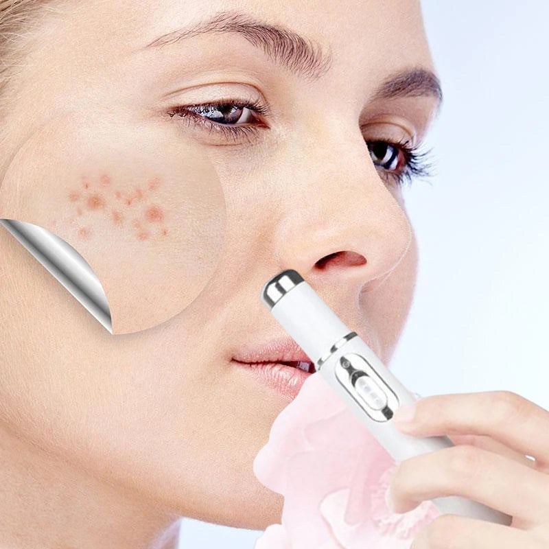 Karnz | ClearDerm - Schnelle, schmerzfreie Pickelentfernung für glatte, klare Haut