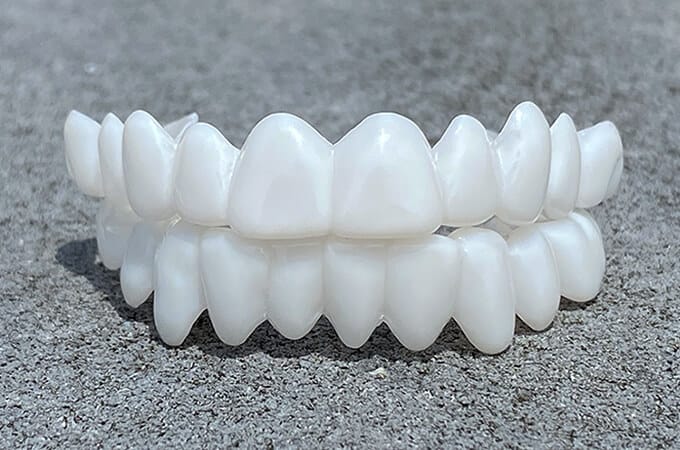 Kosmetische Zahn-Topper SmileShape – Wiederverwendbar, Flexibel und Natürlich Weiß | Karnz