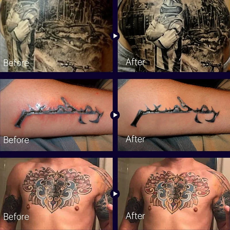 Sandsberg - Tattoo Aufhellungscreme