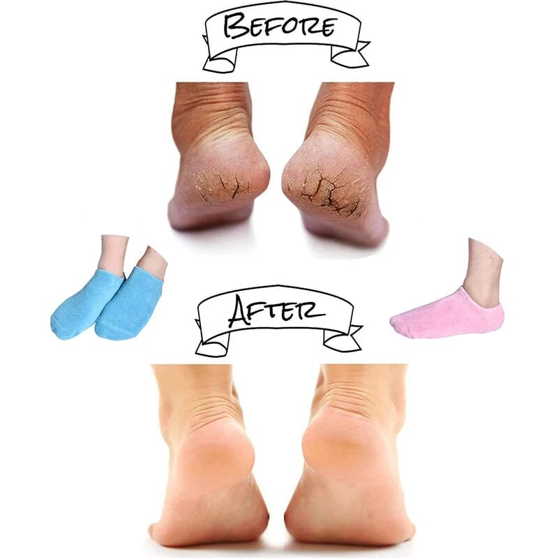 Feuchtigkeitsspendende Socken mit Gel-Beschichtung Karnz