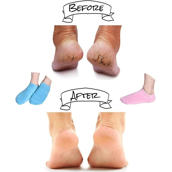 Feuchtigkeitsspendende Socken mit Gel-Beschichtung Karnz