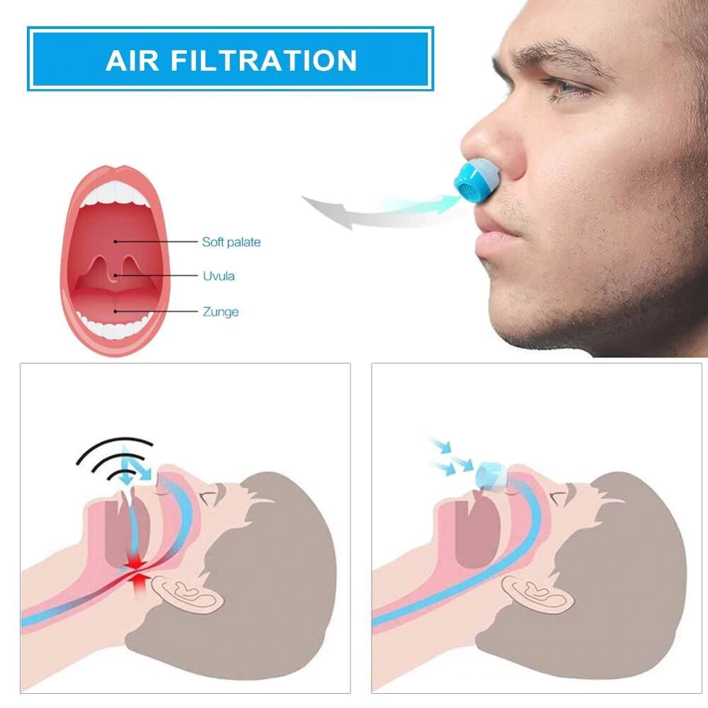 Karnz | Anti-Schnarch-Gerät | Schlauchloses, maskenloses Mikro-CPAP