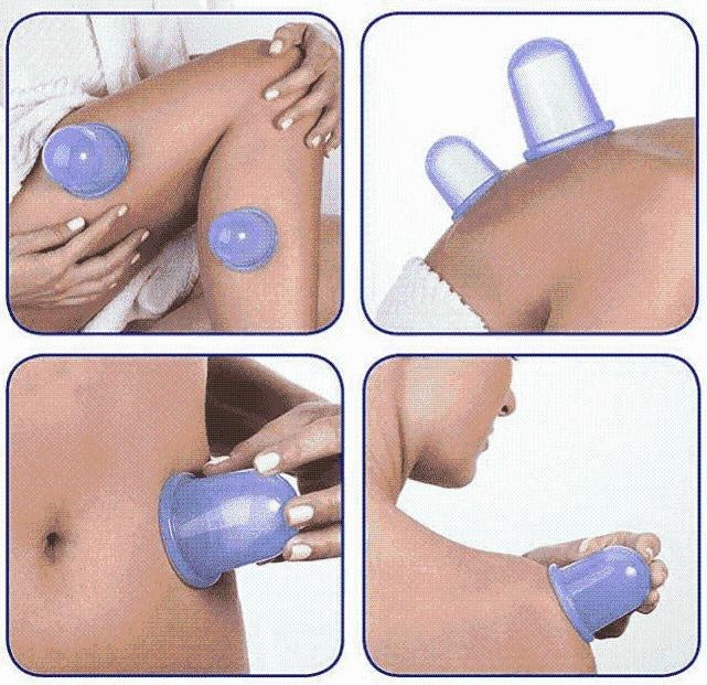 Anti-Cellulite-Vakuum-Silikonbecher | Karnz