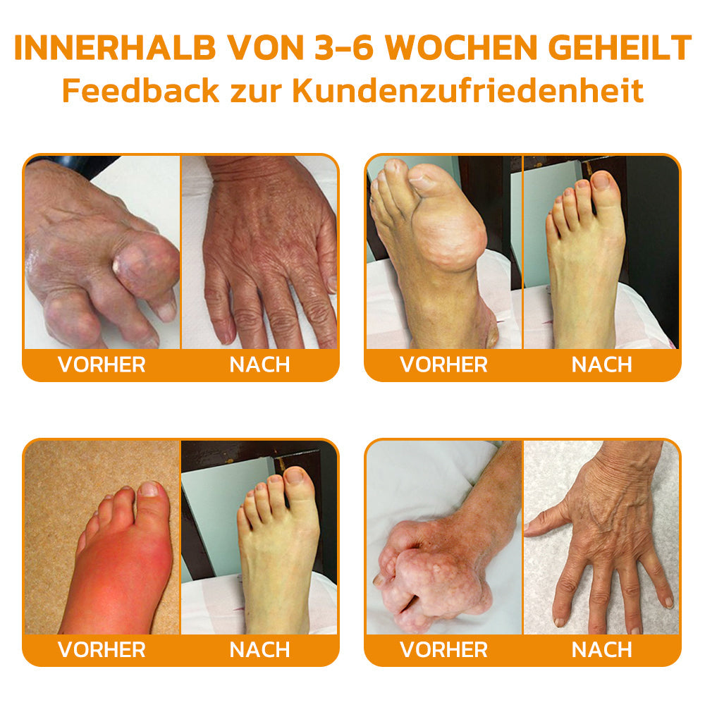 Bienenvenom Gelenkcreme | Karnz