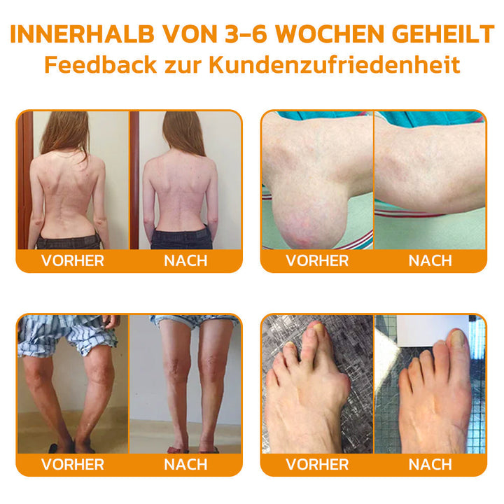 Bienenvenom Gelenkcreme | Karnz