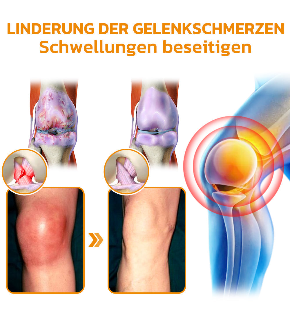 Bienenvenom Gelenkcreme | Karnz
