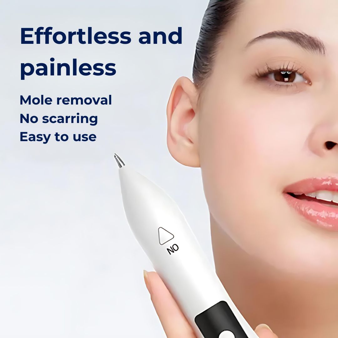 ClearSkinPro Laser Plasma Pen - Nicht-invasiv | zur Entfernung von Sommersprossen, Hautflecken, Punkten, Muttermalen und Tätowierungen zu Hause Karnz