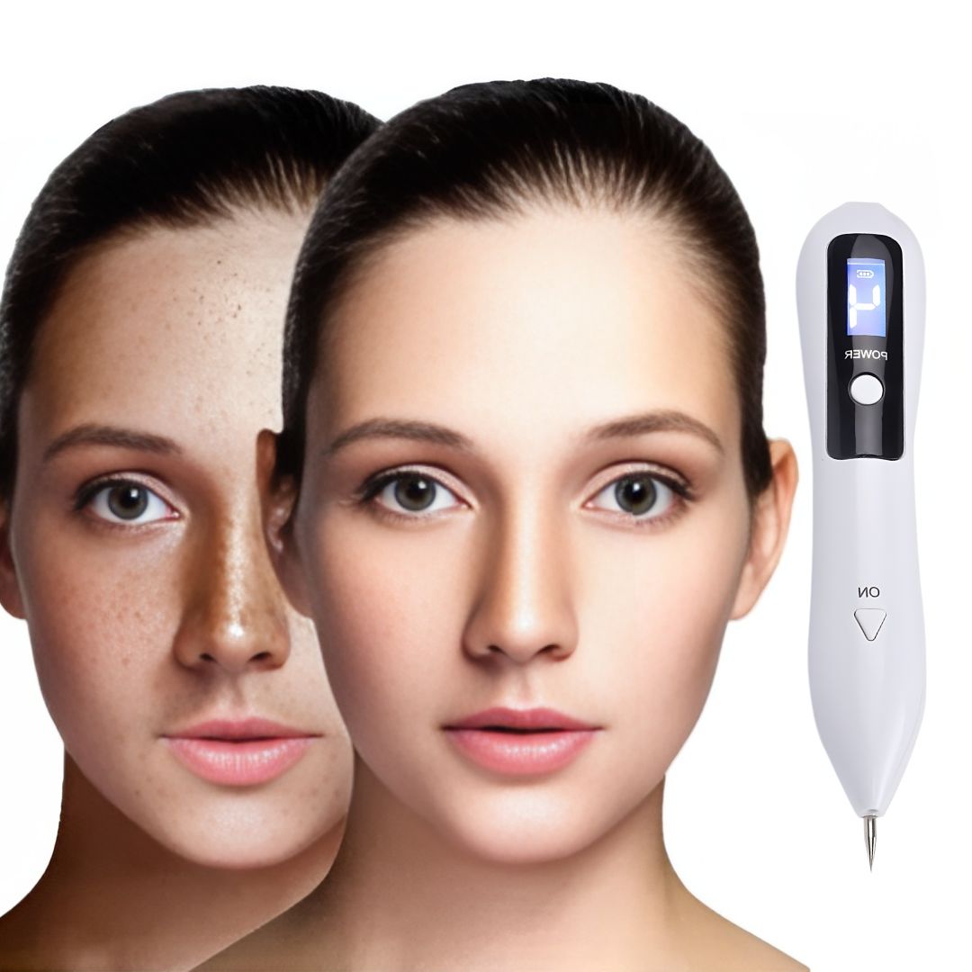 ClearSkinPro Laser Plasma Pen - Nicht-invasiv | zur Entfernung von Sommersprossen, Hautflecken, Punkten, Muttermalen und Tätowierungen zu Hause Karnz