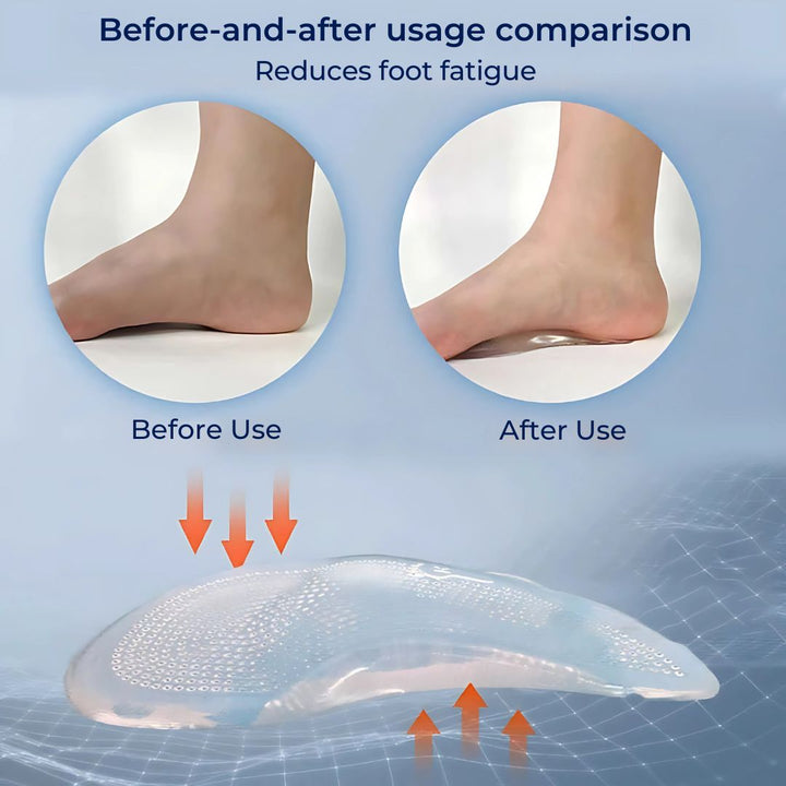 ComfortStep Gel Fußgewölbestütze Einlagen | Schmerzen in den Füßen lindern - Ermüdung reduzieren - Haltung verbessern - Stoßdämpfende Einlagen Karnz