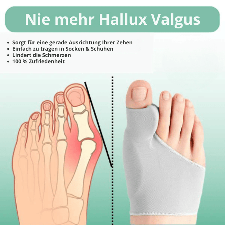 CompressCare Teen – Hallux-valgus-Korrektur für schmerzfreies Gehen