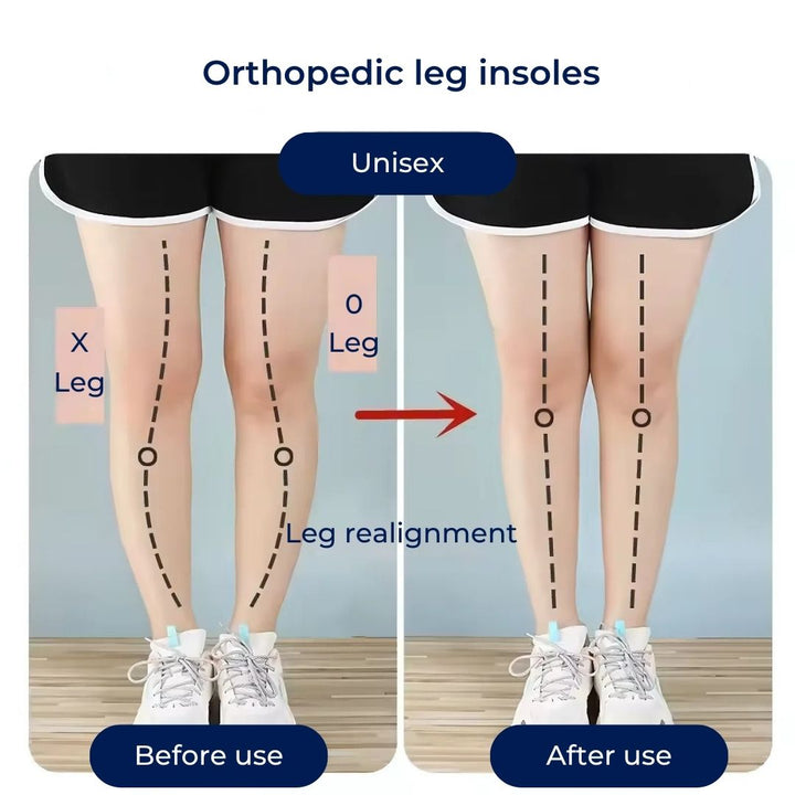 HeelGuard | Silikon-Gel-Fersenkissen – Fersenschmerzlinderung – Gepolsterte Polsterung – Orthopädische Unterstützung für täglichen Komfort Karnz