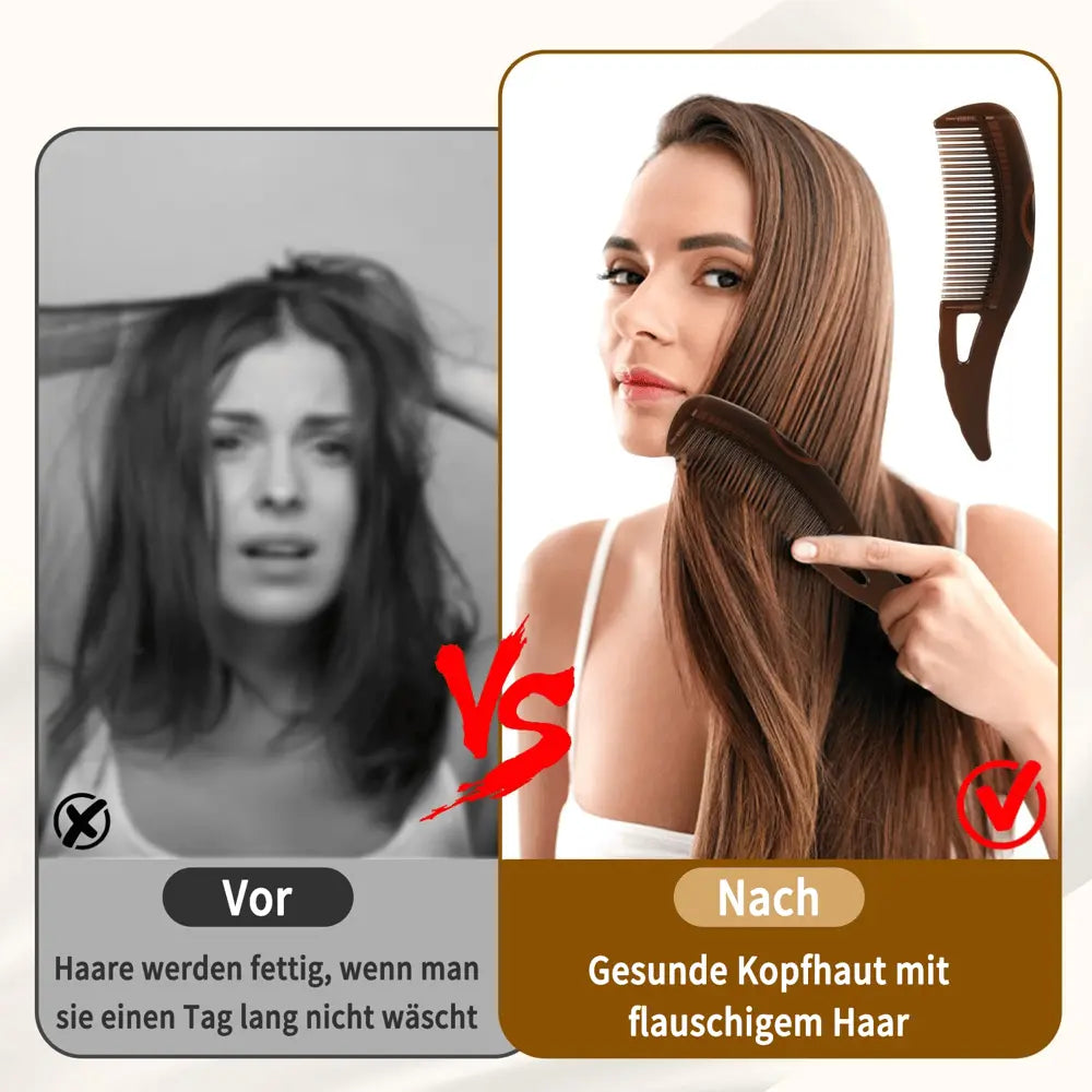 Kopfhautmassage-Kamm – Sanfte Schuppenentfernung & Pflege