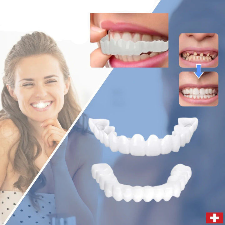 Karnz | SmileSnap Zahnverblendungen – Sofortiges Lächeln mit bequemer Passform