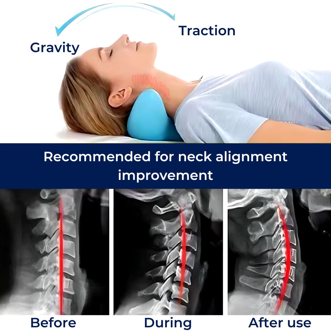 NeckAlign Chiropraktisches Nacken-Kissen | Strecker für Nacken - Schmerzlinderung - Verbesserte Haltung - Besserer Schlaf Karnz