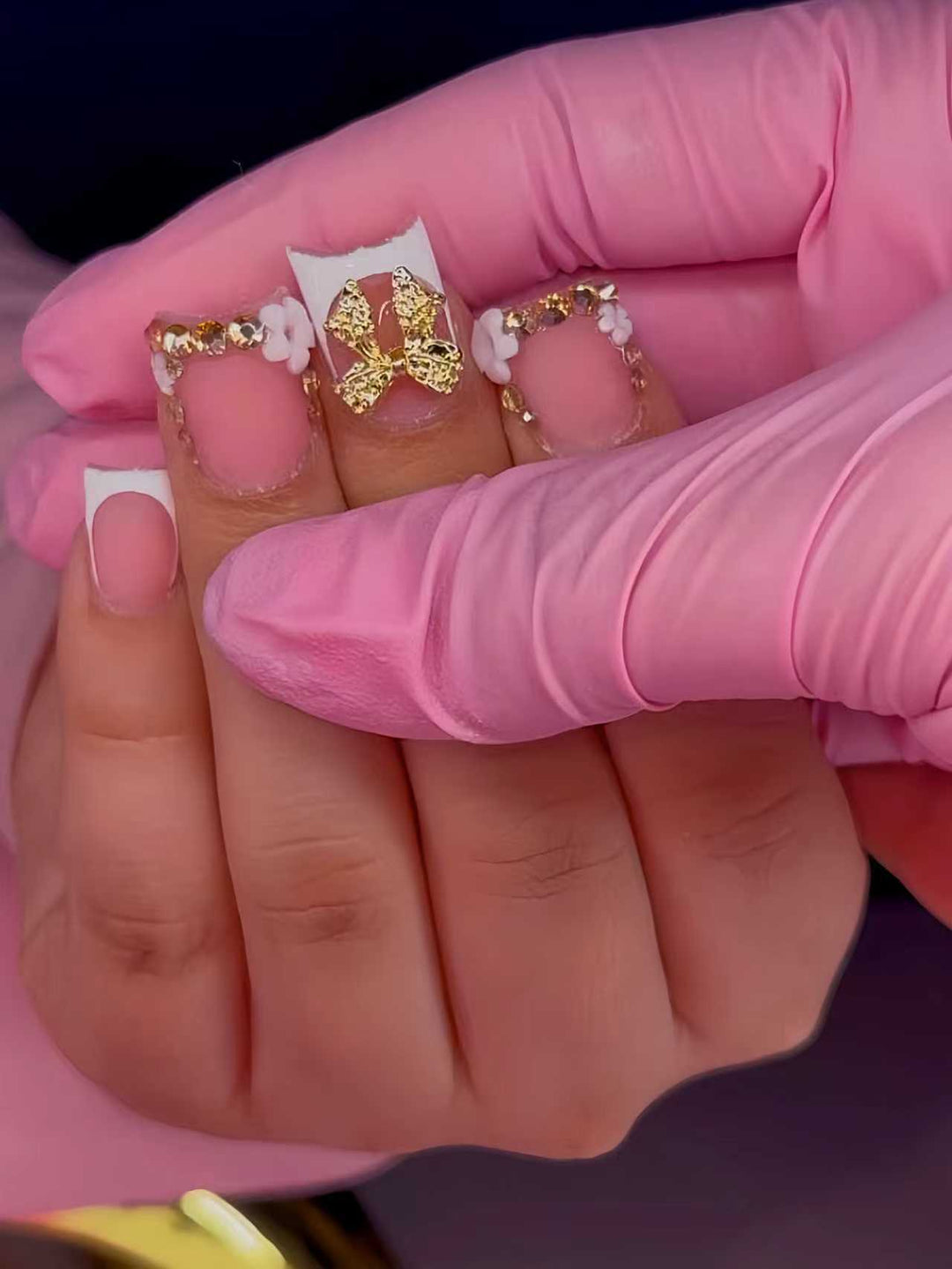 Nagelverstärkungsset Karnz