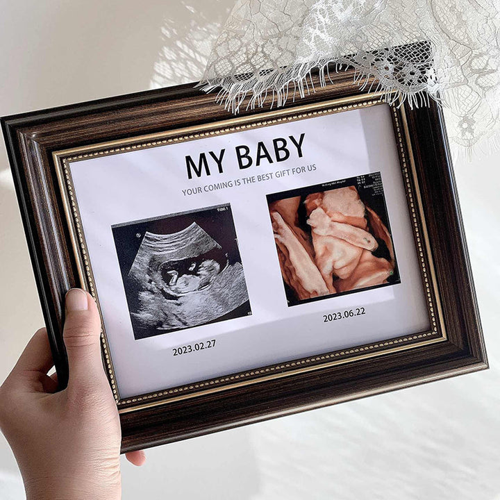 Personalisierter Ultraschall-Foto-Rahmen zur Heimpräsentation
