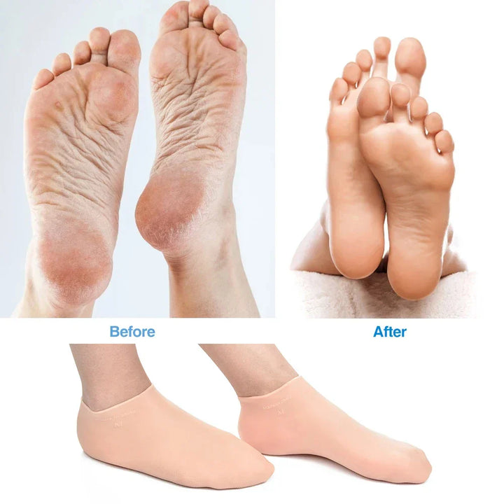Silikon-Neoprenanzug-Strandsocken