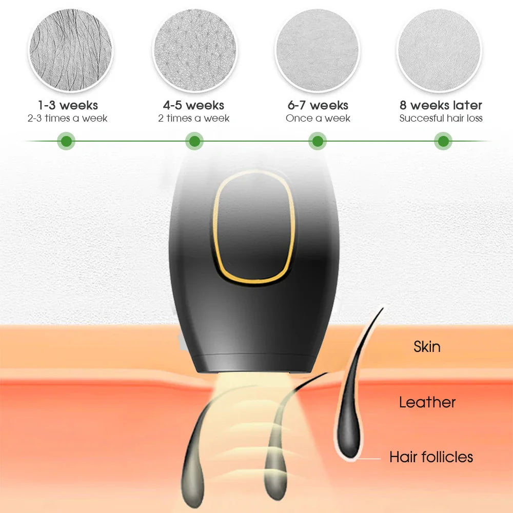 Sandsberg Bikini IPL 500.000 Flash Epilierer Impulse Permanent Laser Epilierer Schmerzlos Für Frauen Haar Entfernung Heimgebrauch Geräte