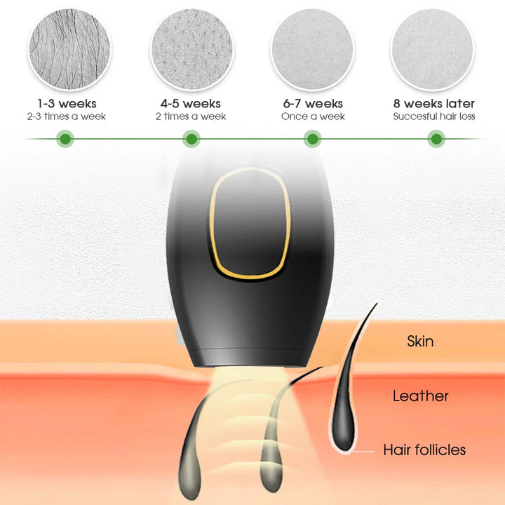 Sandsberg Bikini IPL 500.000 Flash Epilierer Impulse Permanent Laser Epilierer Schmerzlos Für Frauen Haar Entfernung Heimgebrauch Geräte