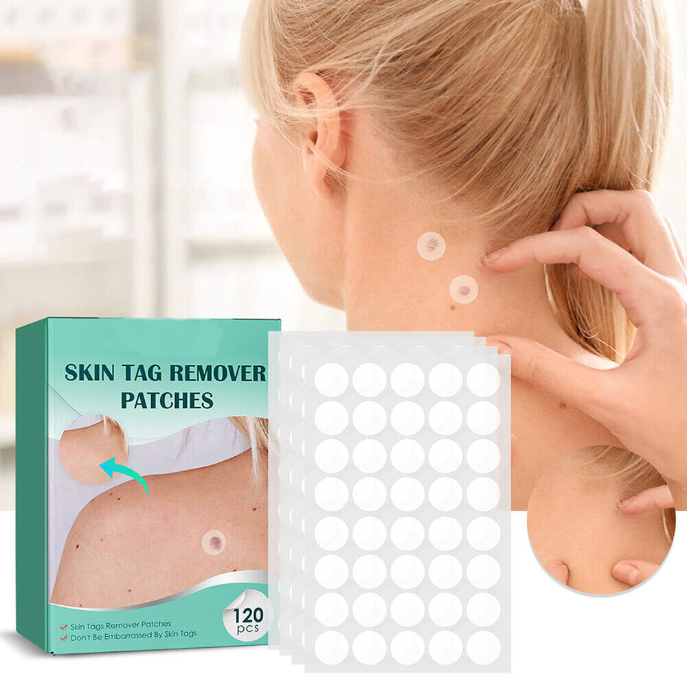 SkinClear - Pflaster zur Entfernung von Flecken und Warzen Karnz