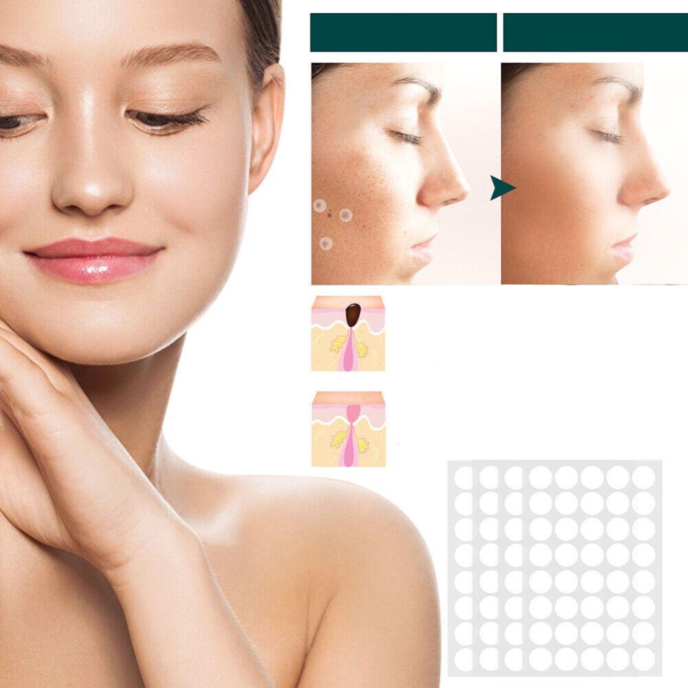 SkinClear - Pflaster zur Entfernung von Flecken und Warzen Karnz