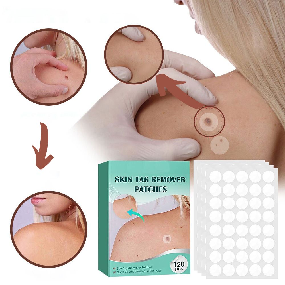 SkinClear - Pflaster zur Entfernung von Flecken und Warzen Karnz
