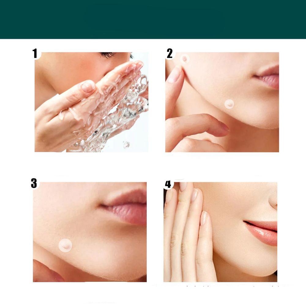 SkinClear - Pflaster zur Entfernung von Flecken und Warzen Karnz