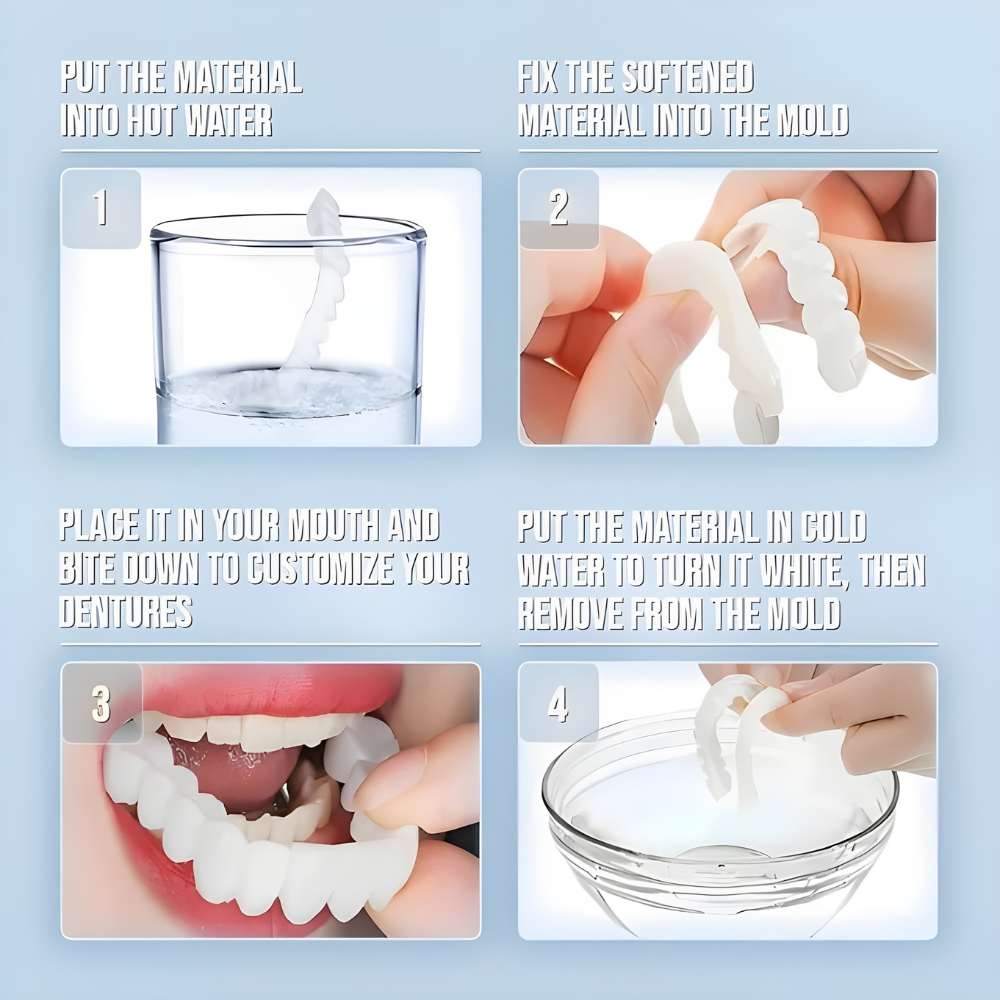 Herausnehmbare Veneers-Zahnverblendschalen