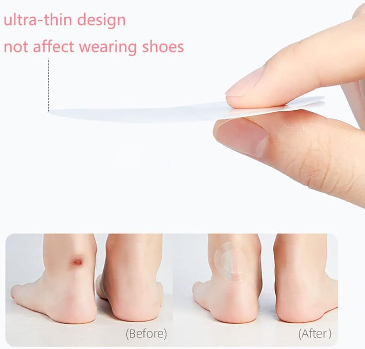 Karnz | SootheStep – Transparente Gel-Pads, die Blasen sofort verhindern
