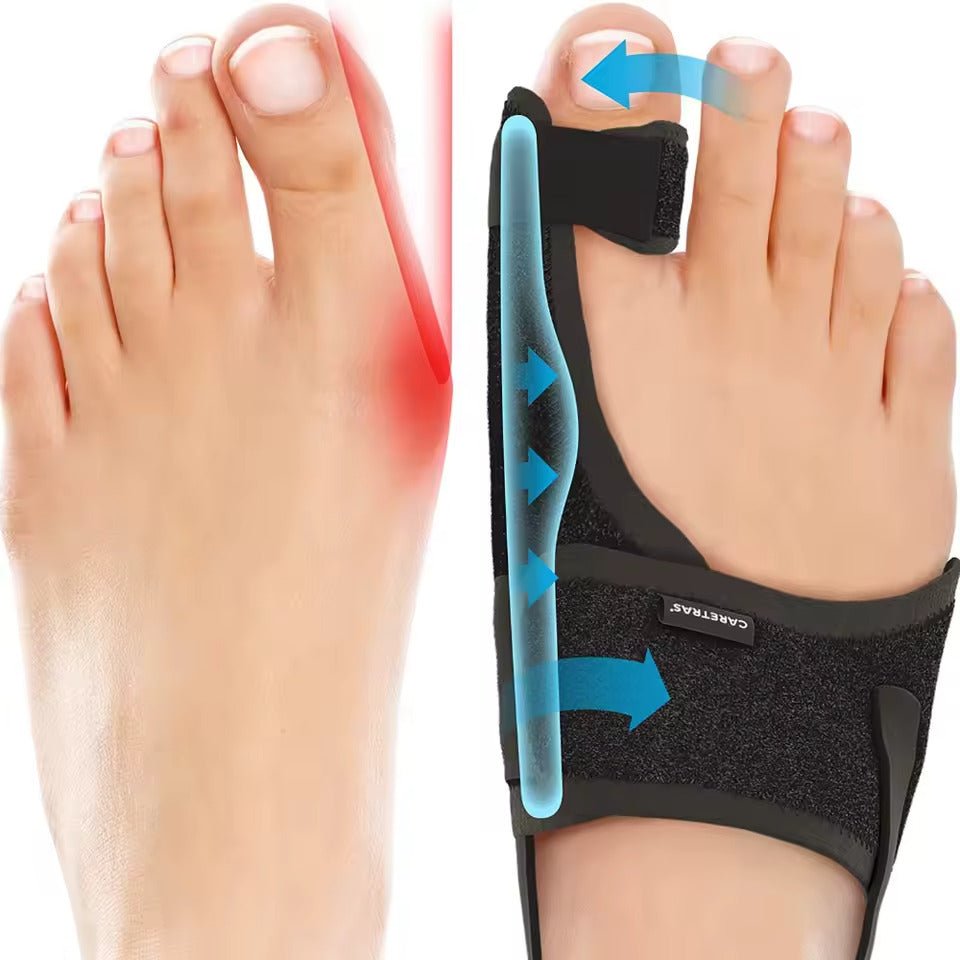 Karnz | Nachtschiene Hallux Valgus - Ergonomisch und verstellbar Komfort