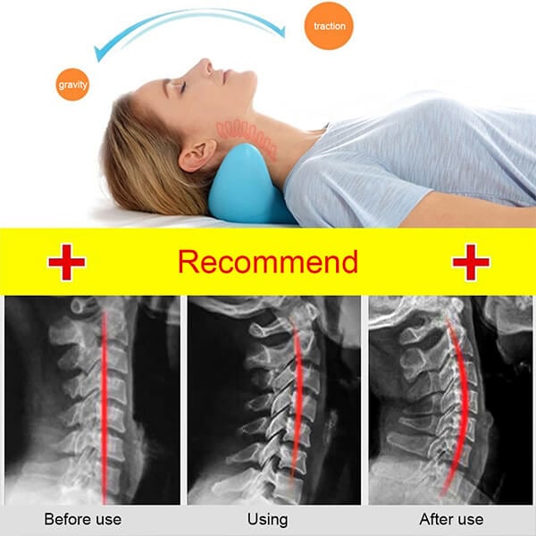NeckEase Stretch – Ergonomisches Nackenkissen für Nackenentspannung | Karnz