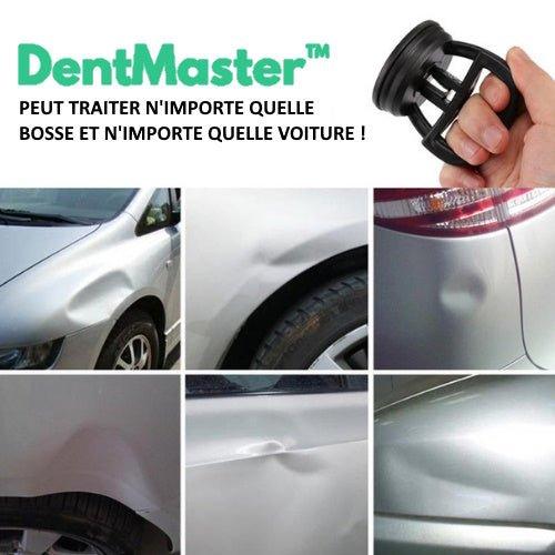 DentMaster Karosserie-Werkzeug für Autos | Karnz