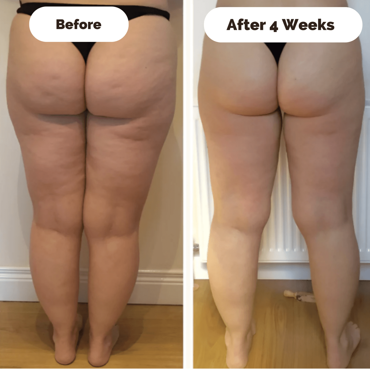 DERMAGLOW – Hautstraffendes Massagegerät gegen Cellulite