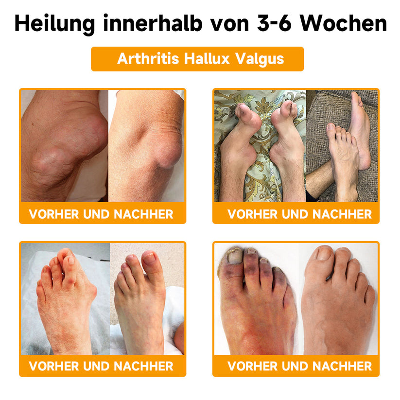 Bienen-Vital-Creme | Schnelle Schmerzlinderung | Karnz